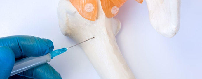 Benign Bone Tumour Treatment