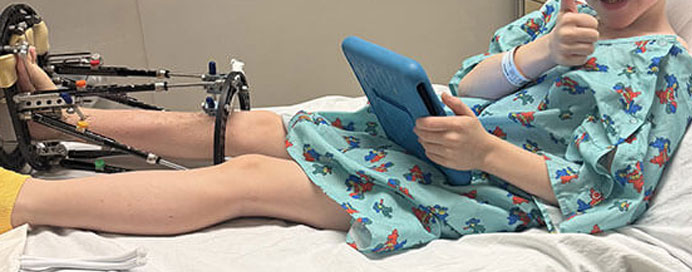 Limb Deformity Correction